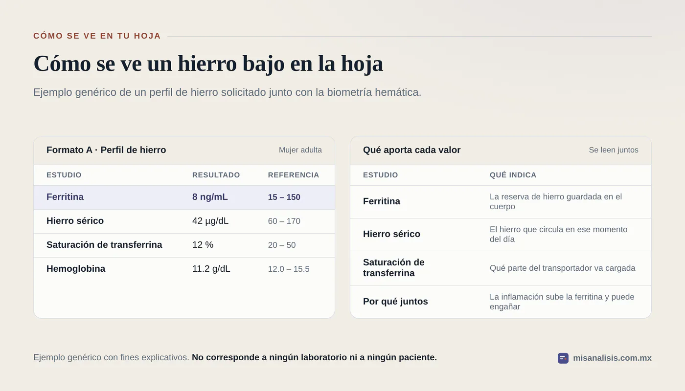 Hoja de resultados de ejemplo con ferritina de 8 ng/mL, hierro sérico de 42 µg/dL y saturación de transferrina de 12 %, los tres debajo del rango, junto con hemoglobina de 11.2 g/dL.